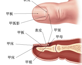 什么原因造成了灰指甲