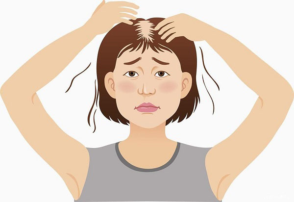 南京那家医院看脱发好