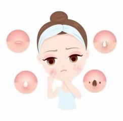 南京皮肤研究所看痘痘哪个医生好?全面解读助你战“痘”到底
