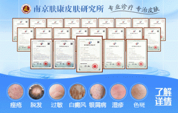 南京皮炎所在哪里预约？