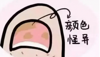 大脚趾甲发黑灰：原因及治疗