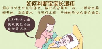 南京哪家医院治疗湿疹