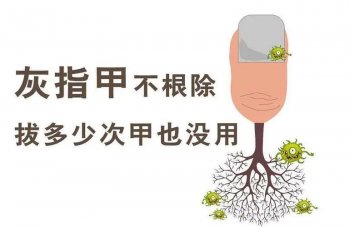 南京皮肤病研究所看灰指甲挂什么科