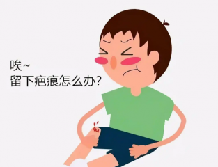 疤痕疙瘩怎么能消除