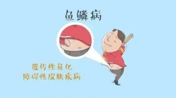 鱼鳞腿干燥起皮怎么办