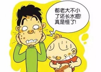 南京皮研所看带状疱疹好吗