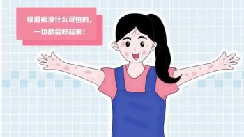 寻常型牛皮癣危害有多大