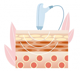 京哪家医院做激光皮秒去色素好