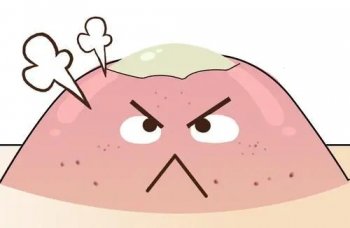 鼻子长脓包型痘痘怎么处理