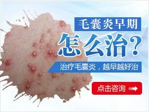 毛囊炎怎么治疗